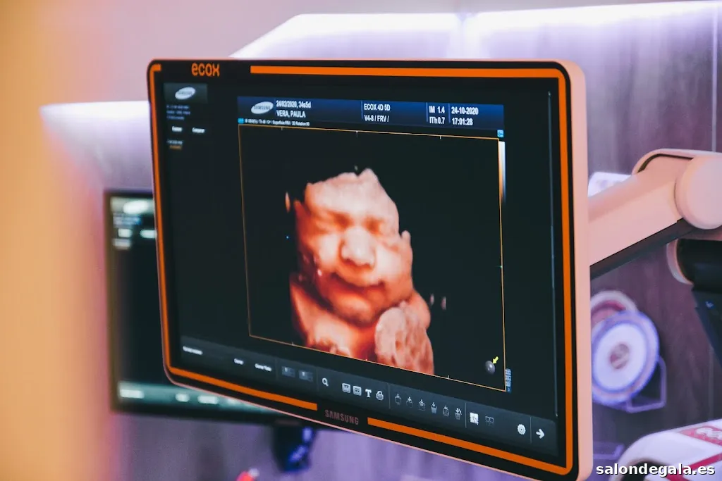 Ecox Majadahonda, Madrid | Especialistas en Ecografías 5D, 4D y 8K