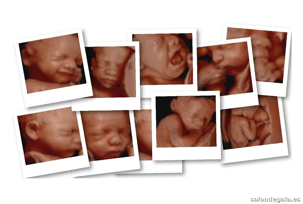 Ecox Igualada, Barcelona | Especialistas en ecografías 5D, 4D y 8K